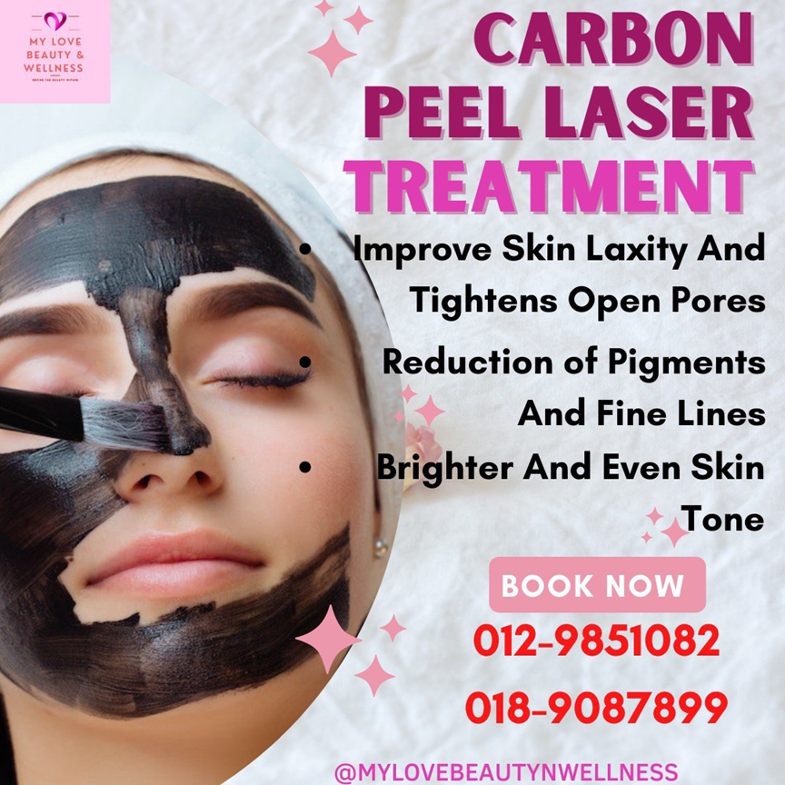 Carbon Peel Laser Treatment